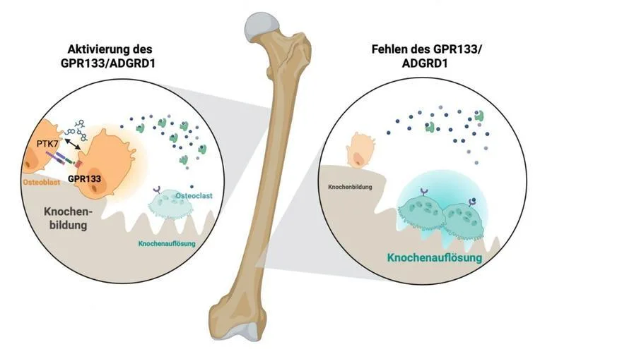 Científicos descubren cómo revertir la osteoporosis