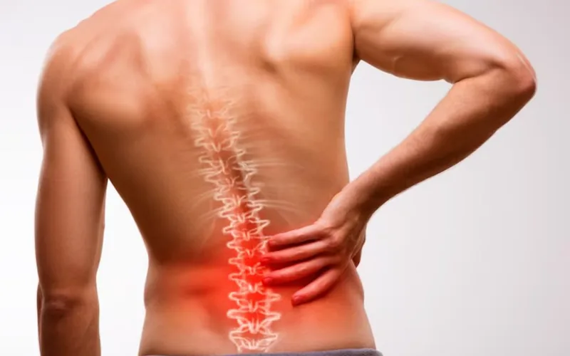 La enfermedad inflamatoria que se disfraza de dolor de espalda