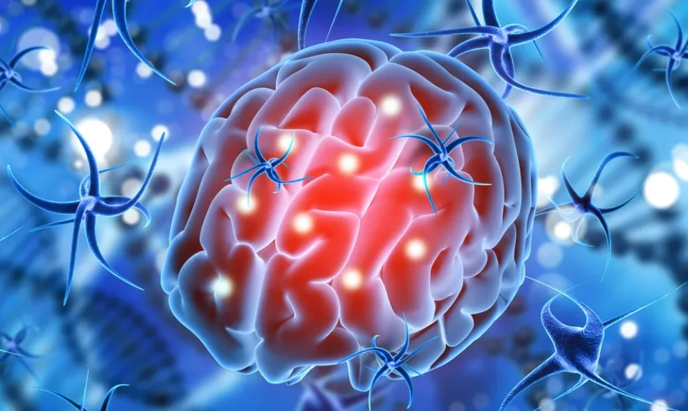 Llega a Argentina un nuevo tratamiento para gliomas tras dos décadas